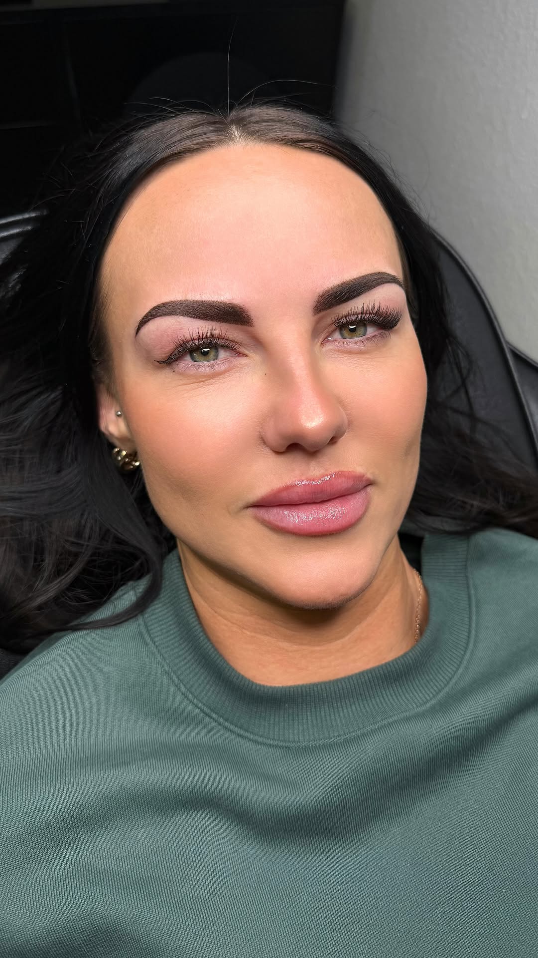 Natural brows before combo treatment
